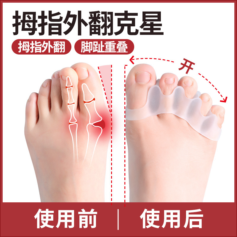Toe orthosis big female toe thumb valgus orthosis toe overlap separator can wear shoes for men and women