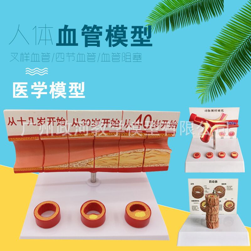 Coronary artery cardiovascular artery model Sclerosis model Elderly heart model Thrombosis Teaching model