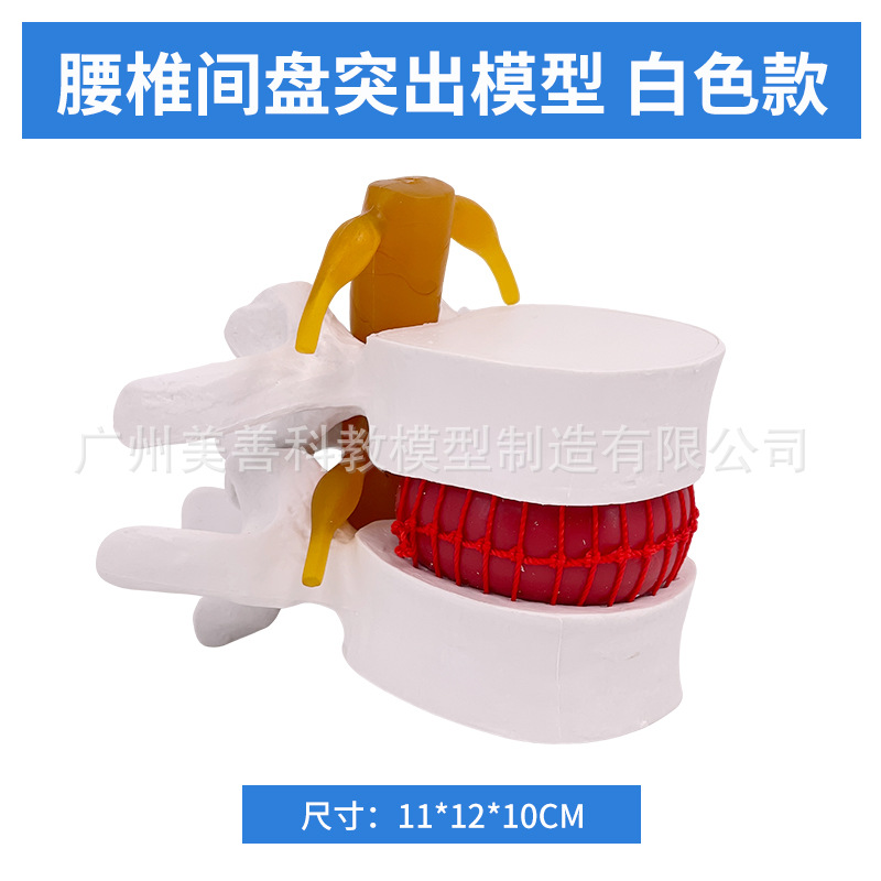 Picture of Lumbar model teaching medical human lumbar disc compression demonstration spinal bone extrusion pathology bone teaching aids