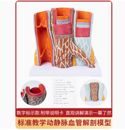 Picture of Coronary artery cardiovascular artery model Sclerosis model Human pathological model Thrombus model