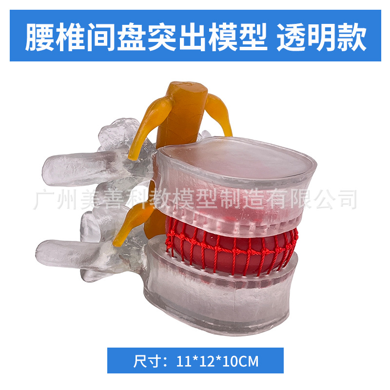 Picture of Lumbar model teaching medical human lumbar disc compression demonstration spinal bone extrusion pathology bone teaching aids