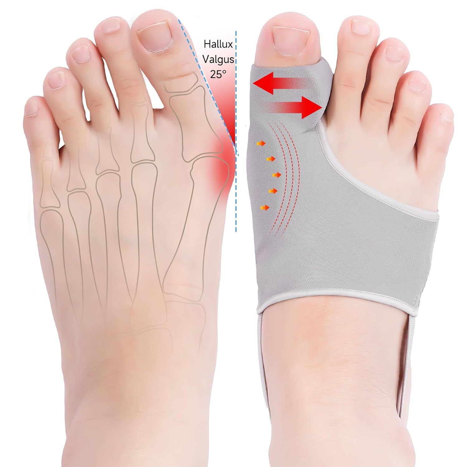 Toe Corrector Improves Thumb Valgus, Big Toe Painless Correction Toe Separator, Daily Wearable Shoes