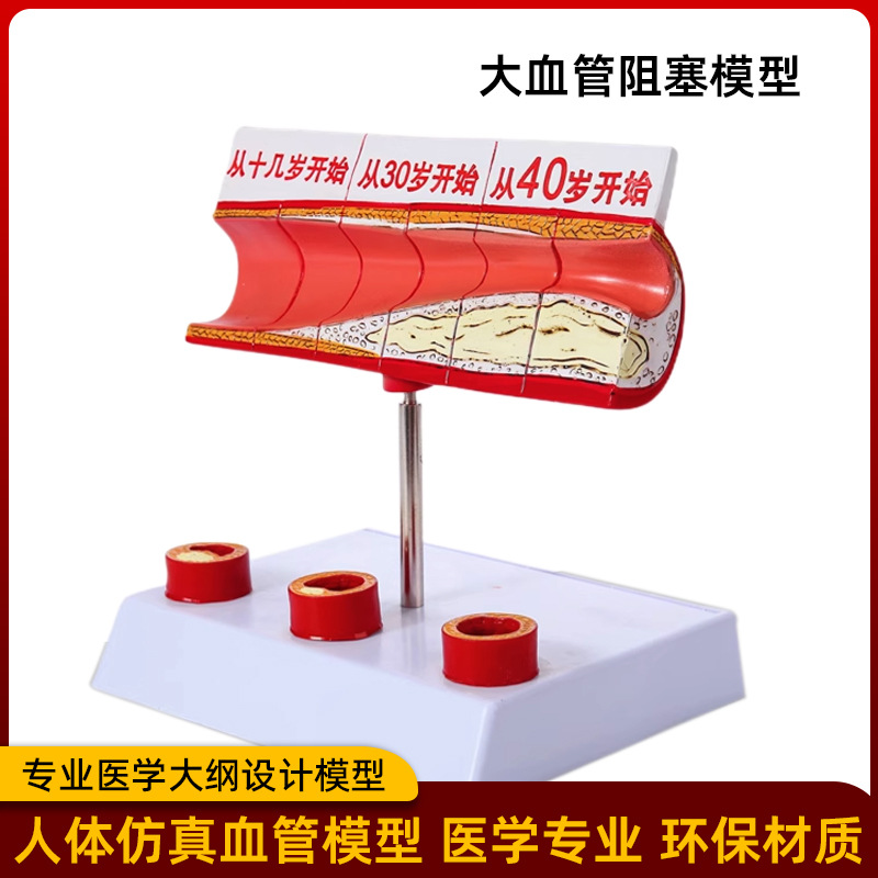 Picture of Coronary artery cardiovascular artery model Sclerosis model Human pathological model Thrombus model