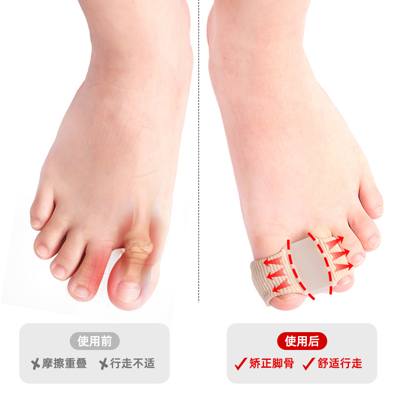 Picture of Toe Splitter Thumb valgus Big Foot Bone Overlapping Toe Splitter Men's and Women's Fiber Double Hole Toe Orthosis