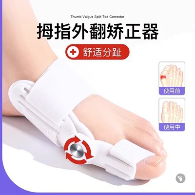 Thumb valgus orthosis big foot bone protrusion overlap deformation toe separator knob buckle adjustable