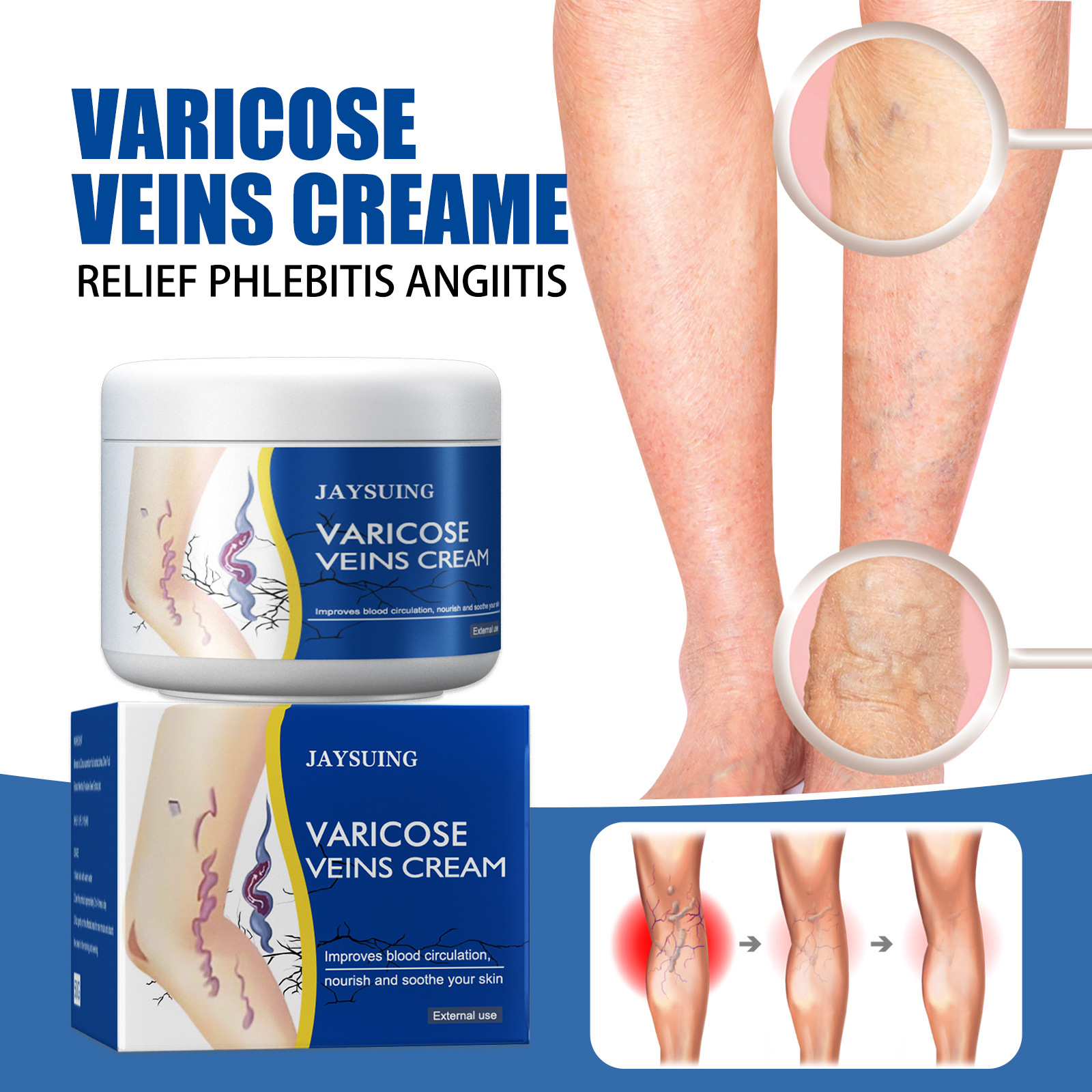 Jaysuing Leg Vein Repair Cream Qu Zhang Massage Earthworm Leg Pain Swelling Activating Collaterals External Use Cream