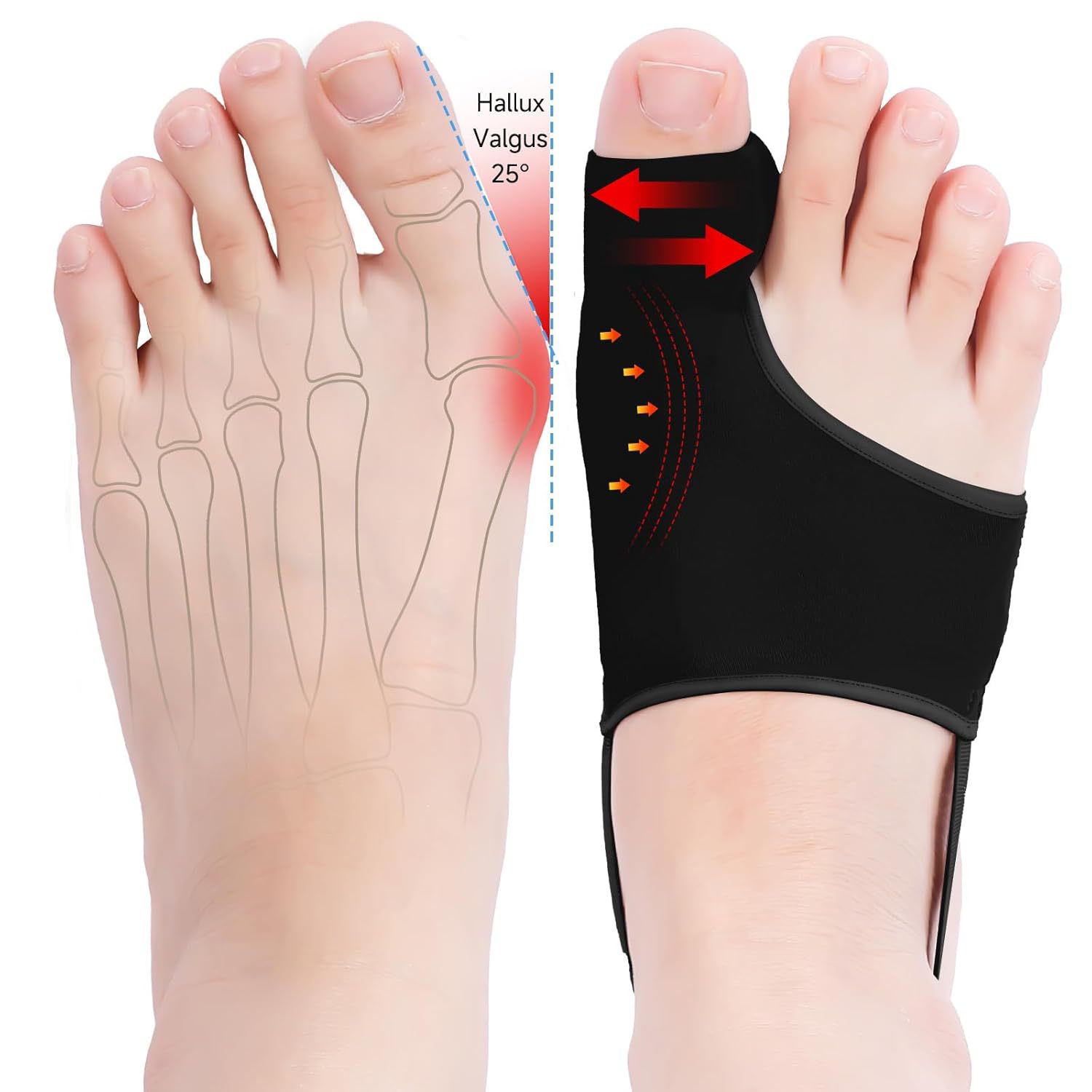 Big female toe protector silicone thumb valgus corrector toe-splitting orthopedic daily night wear shoes