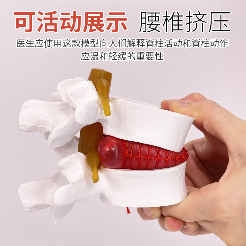 Picture of Lumbar model teaching medical human lumbar disc compression demonstration spinal bone extrusion pathology bone teaching aids