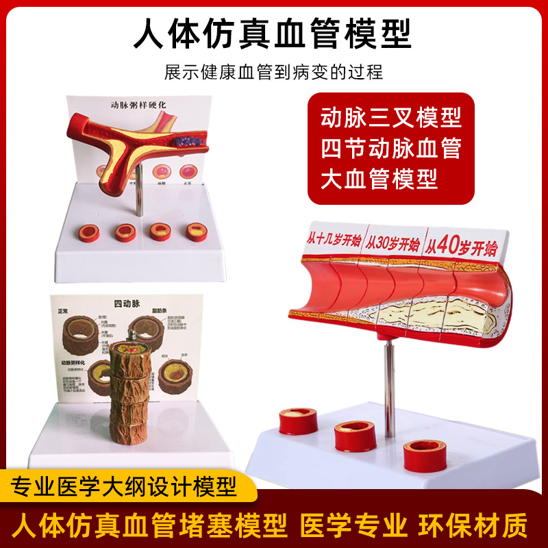 Coronary artery cardiovascular artery model Sclerosis model Human pathological model Thrombus model