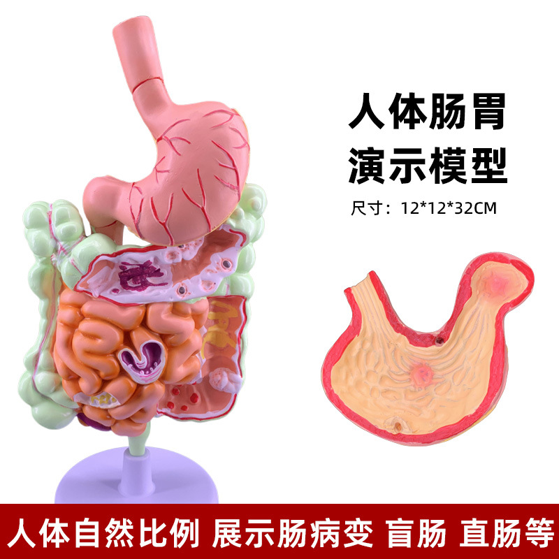 Picture of human large intestine pathological model gastrointestinal anatomy model pathological large intestine cecum rectum duodenal model
