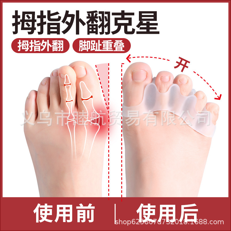 Thumb valgus toe orthosis five toe overlapping separation little toe valgus anti-wear toe divider universal silicone ZL