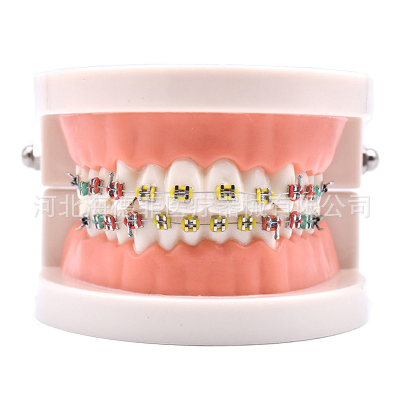 Orthodontic correction model standard 1 times large metal bracket model dental bracket model dental model