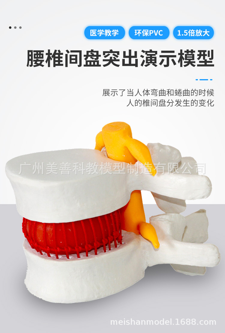 Picture of Lumbar enlarged lumbar disc compression demonstration model human spine spine pathology demonstration Joint Medical use