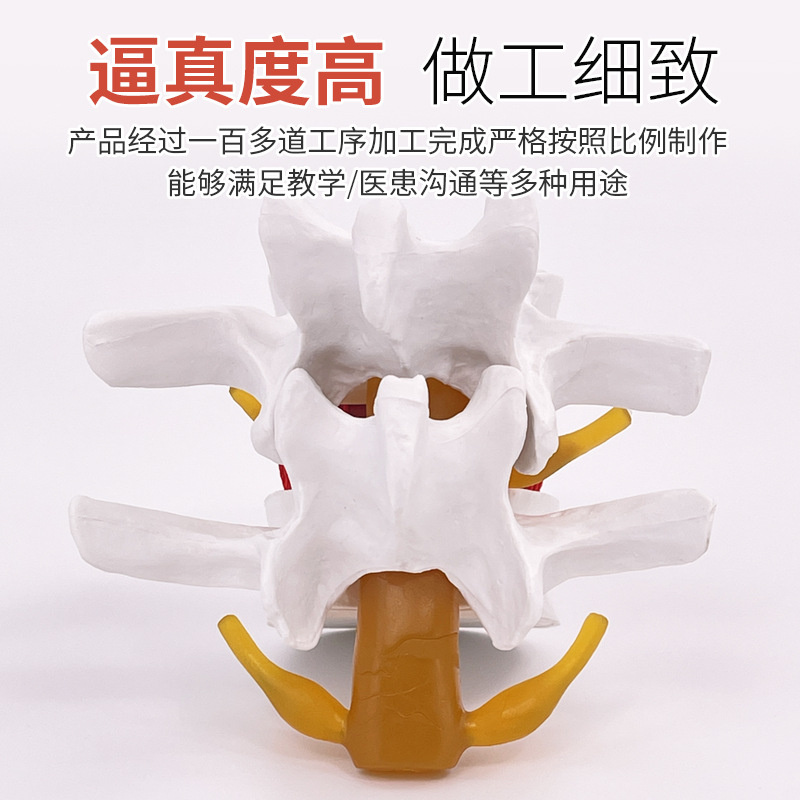 Picture of Lumbar model teaching medical human lumbar disc compression demonstration spinal bone extrusion pathology bone teaching aids