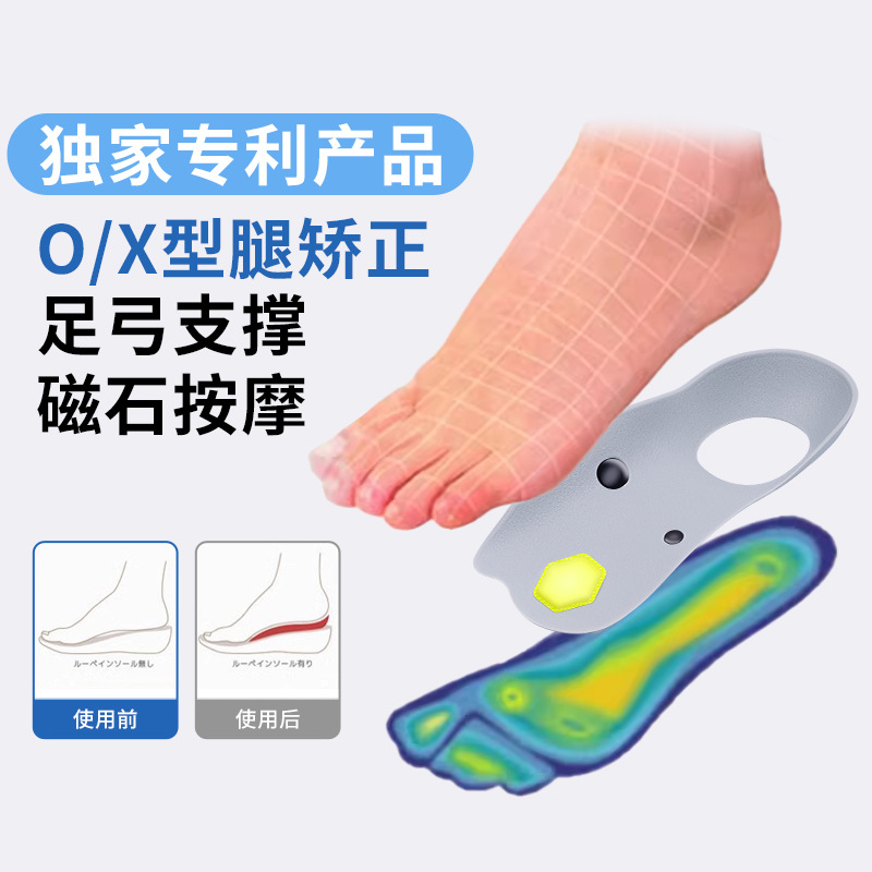flat foot corrective insole xo type leg plantar fascia magnet massage insole foot valgus high arch pad support pad