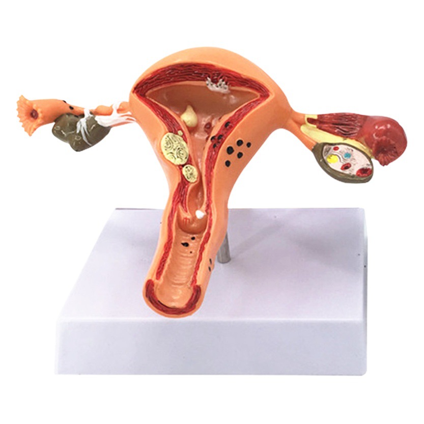 Female large uterus model enlarged model female reproductive anatomy model family planning teaching model